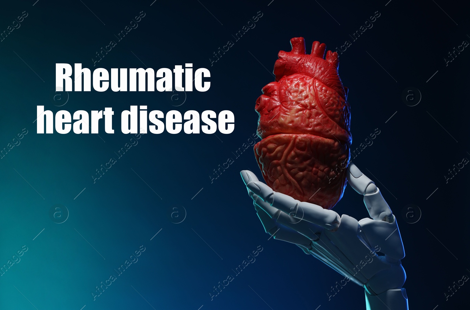 Image of Rheumatism. Robot hand holding model of human heart on blue gradient background with words Rheumatic Heart Disease