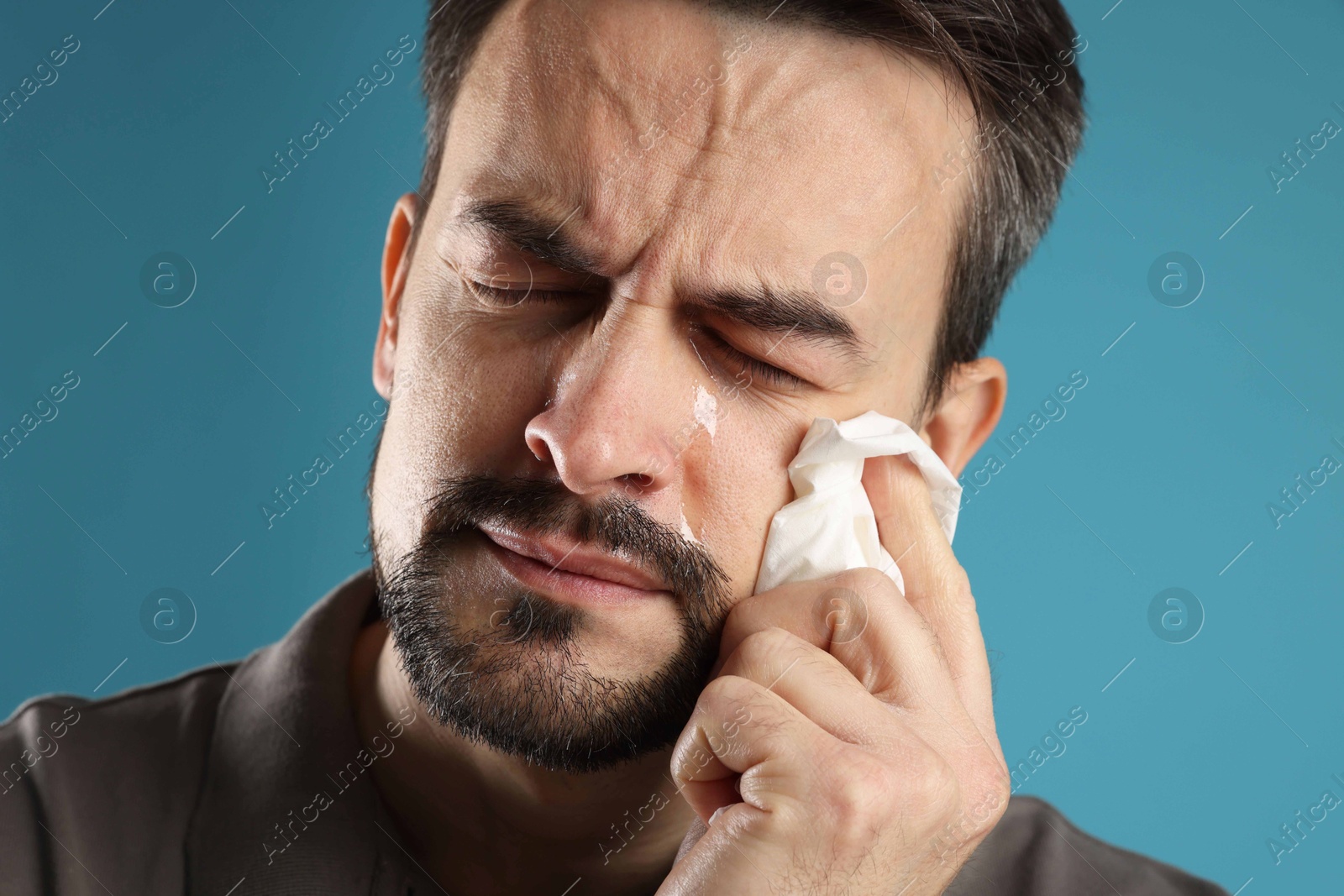 Photo of Sad man with paper tissue crying on light blue background