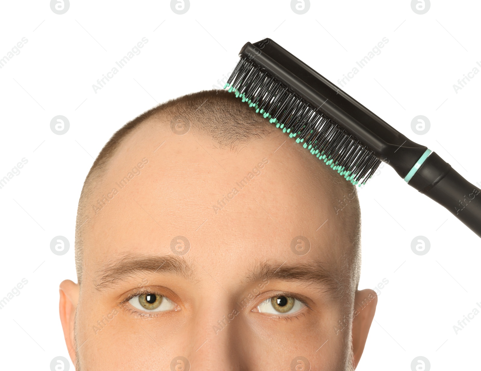 Photo of Baldness problem. Man brushing his hair on white background, closeup