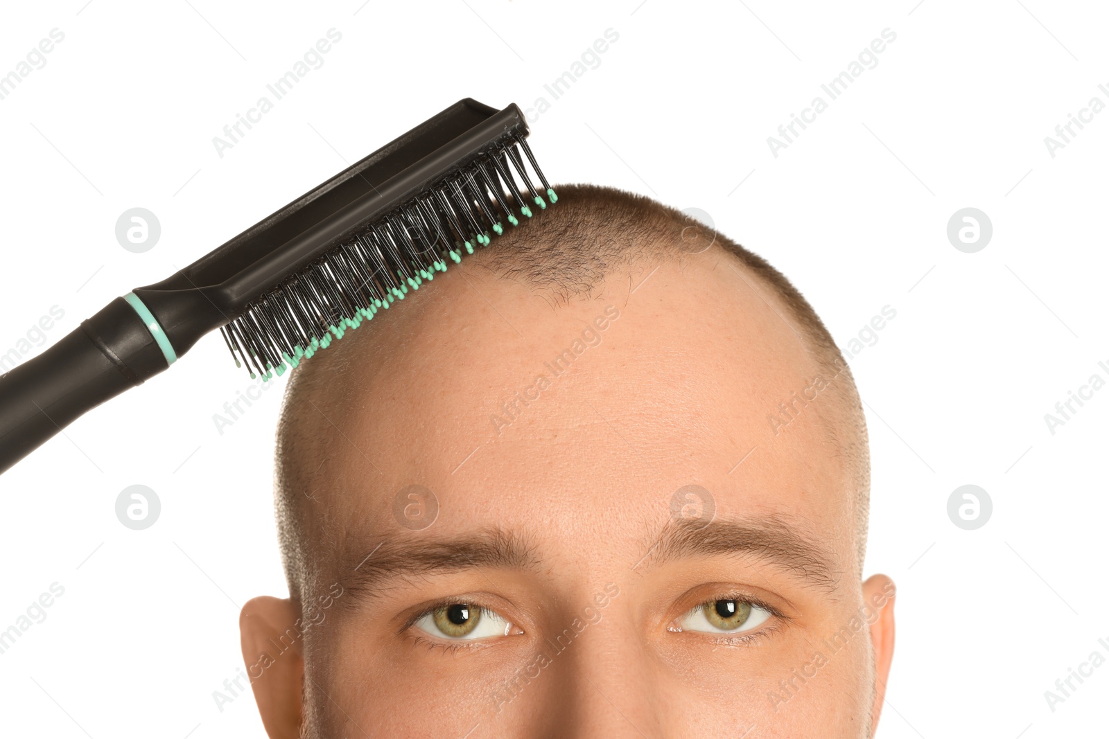 Photo of Baldness problem. Man brushing his hair on white background, closeup