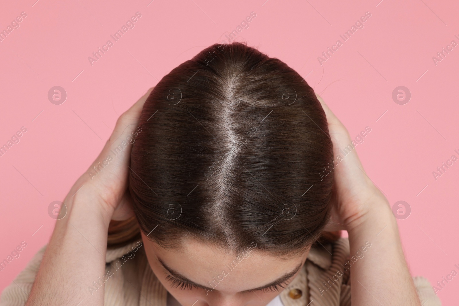 Photo of Girl with hair loss problem on pink background