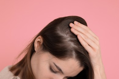 Photo of Girl with hair loss problem on pink background, closeup