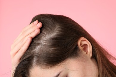 Photo of Girl with hair loss problem on pink background, closeup