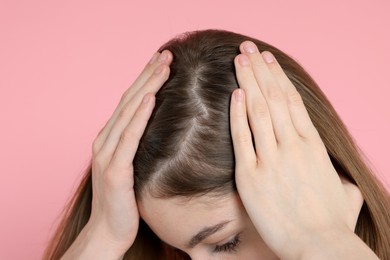 Photo of Girl with hair loss problem on pink background, closeup