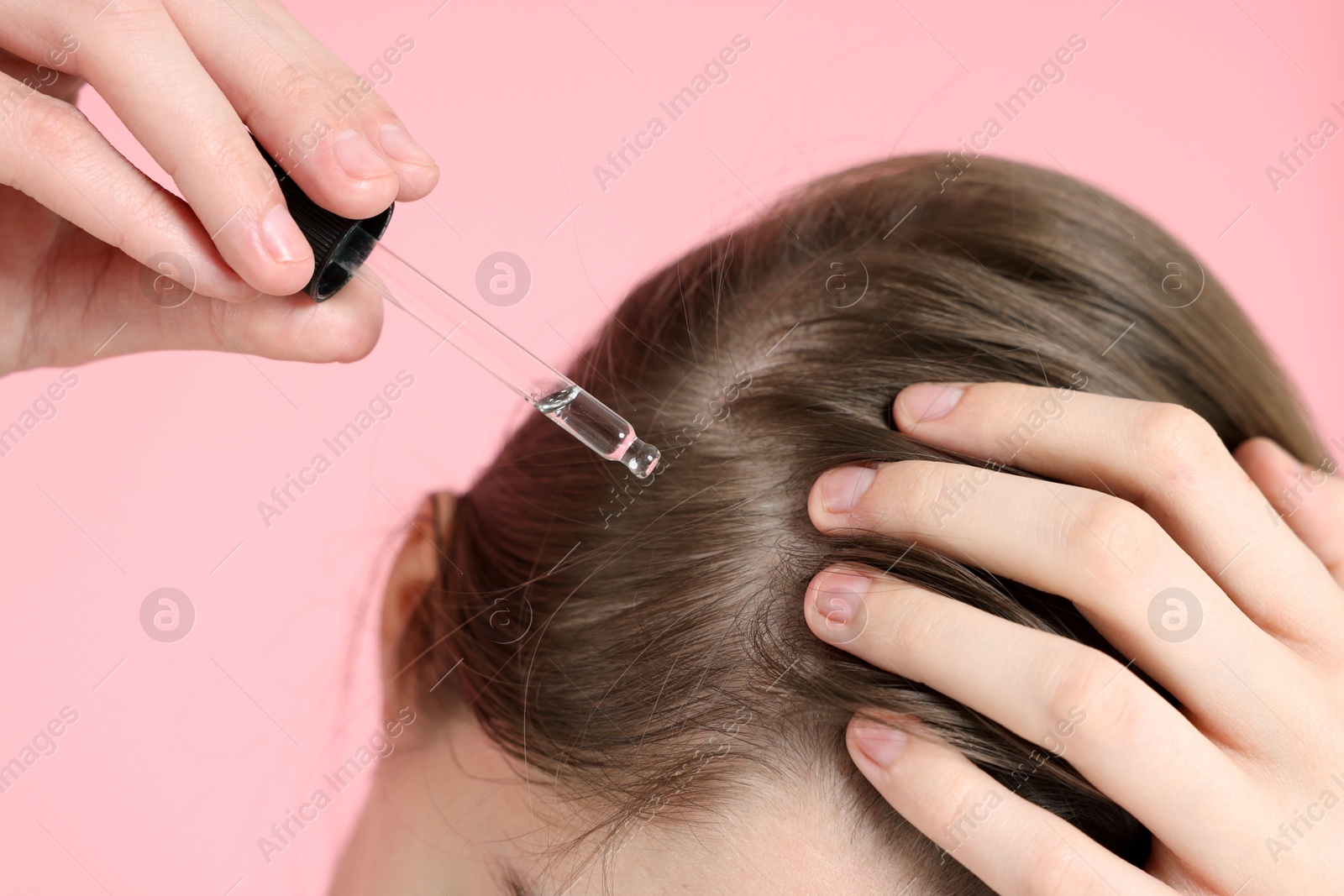 Photo of Hair loss problem. Girl applying serum onto hairline on pink background, closeup