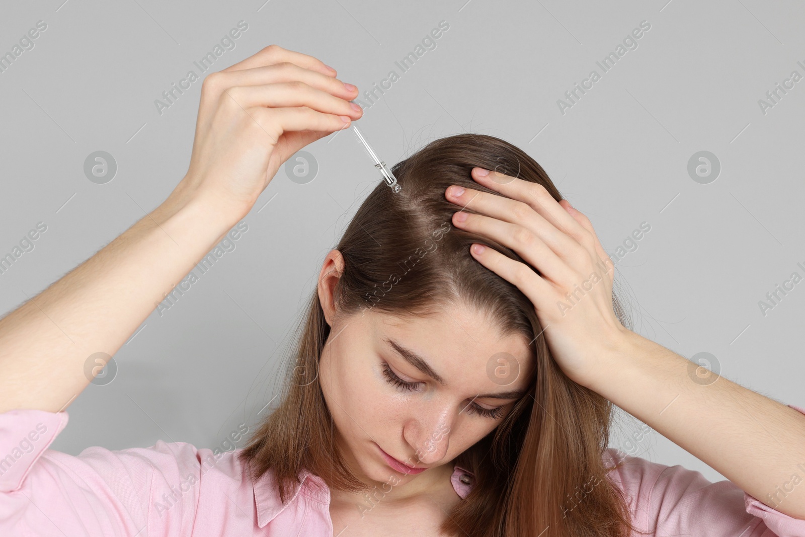 Photo of Hair loss problem. Girl applying serum onto hairline on grey background