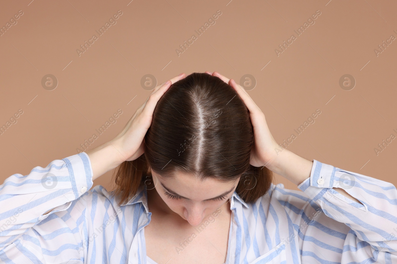 Photo of Girl with hair loss problem on dark beige background