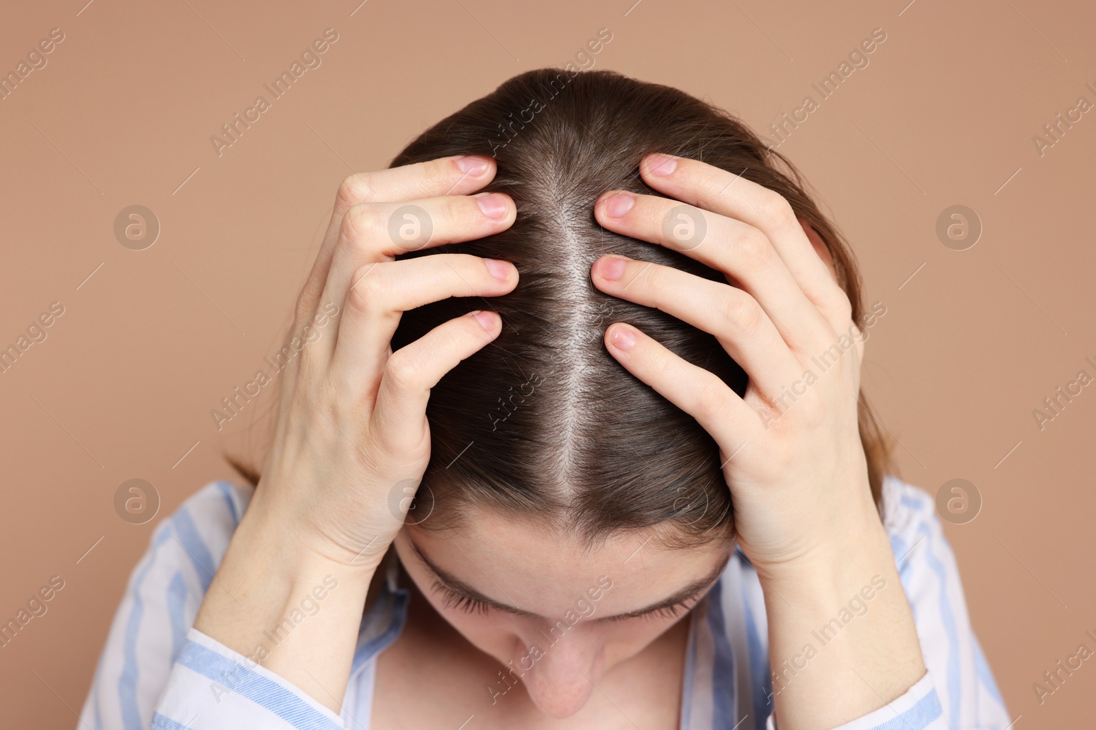 Photo of Girl with hair loss problem on dark beige background