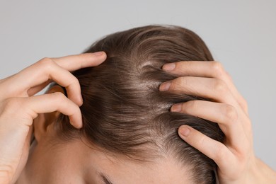 Photo of Girl with hair loss problem on grey background, closeup