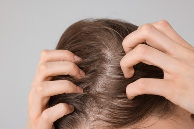 Photo of Girl with hair loss problem on grey background, closeup