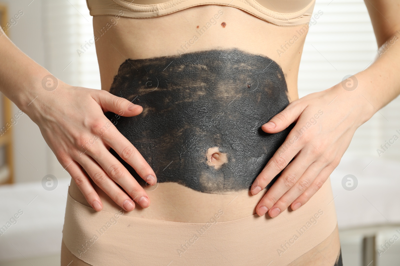 Photo of Woman doing spa body wraps on her belly in salon, closeup