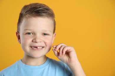 Photo of Cute little boy with missing tooth on orange background, space for text. Waiting for tooth fairy