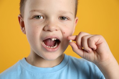 Photo of Cute little boy with missing tooth on orange background. Waiting for tooth fairy