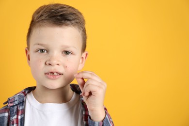 Photo of Cute little boy with missing tooth on orange background, space for text. Waiting for tooth fairy