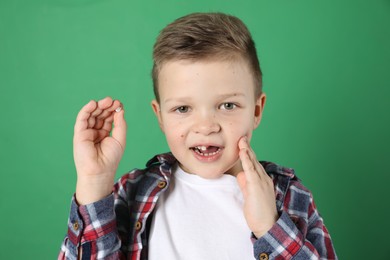 Cute little boy with missing tooth on green background. Waiting for tooth fairy