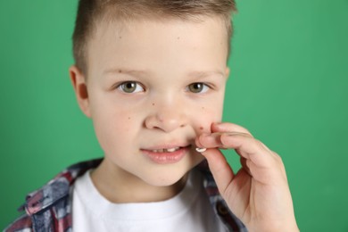 Photo of Cute little boy with missing tooth on green background, closeup. Waiting for tooth fairy