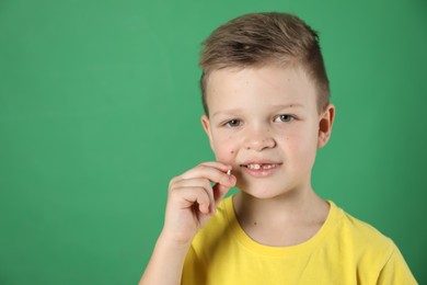 Photo of Cute little boy with missing tooth on green background, space for text. Waiting for tooth fairy