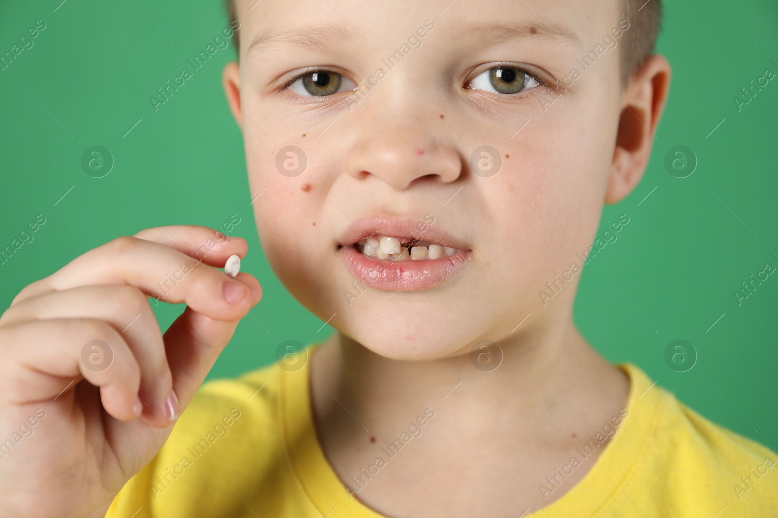 Photo of Cute little boy with missing tooth on green background, closeup. Waiting for tooth fairy