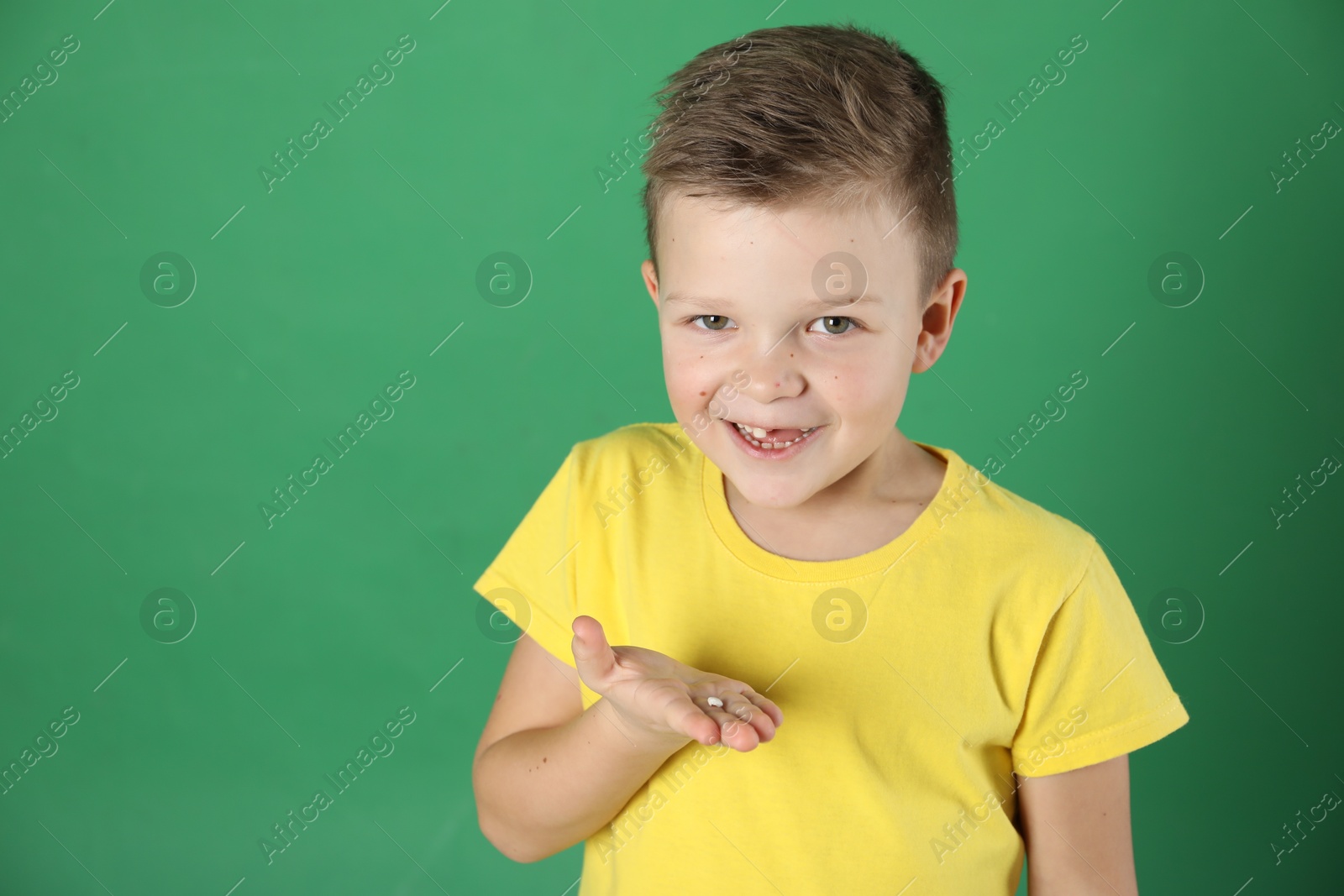 Photo of Cute little boy with missing tooth on green background, space for text. Waiting for tooth fairy