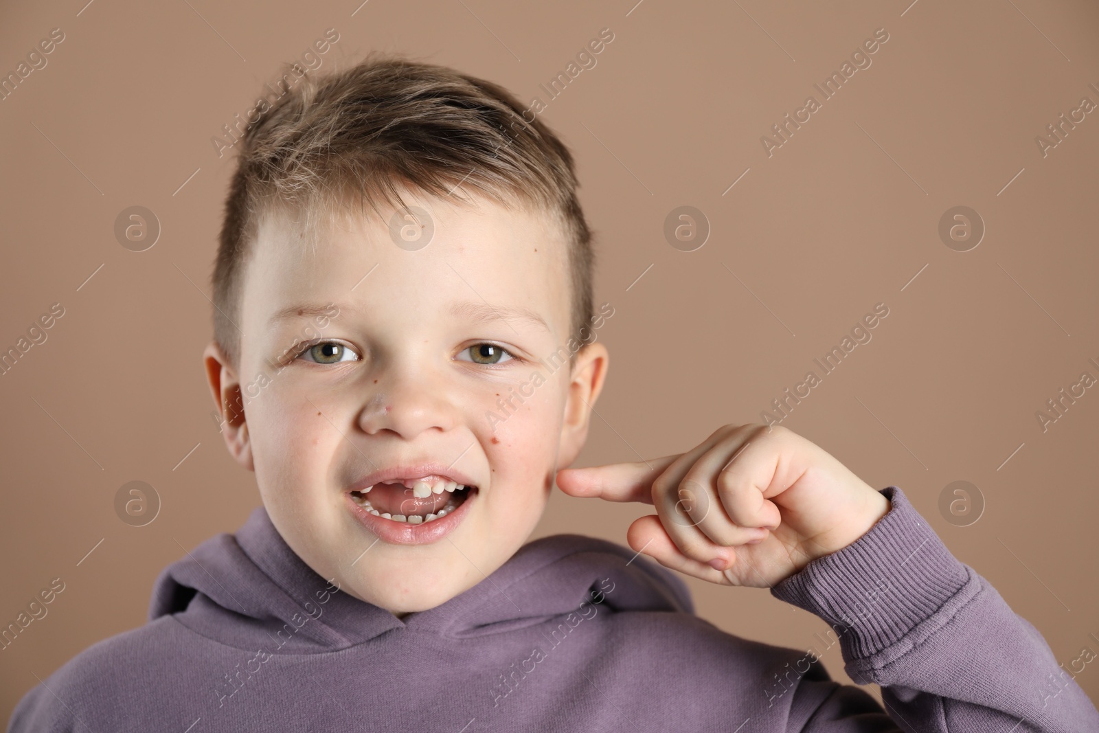 Photo of Cute little boy pointing at his missing tooth on dark beige background