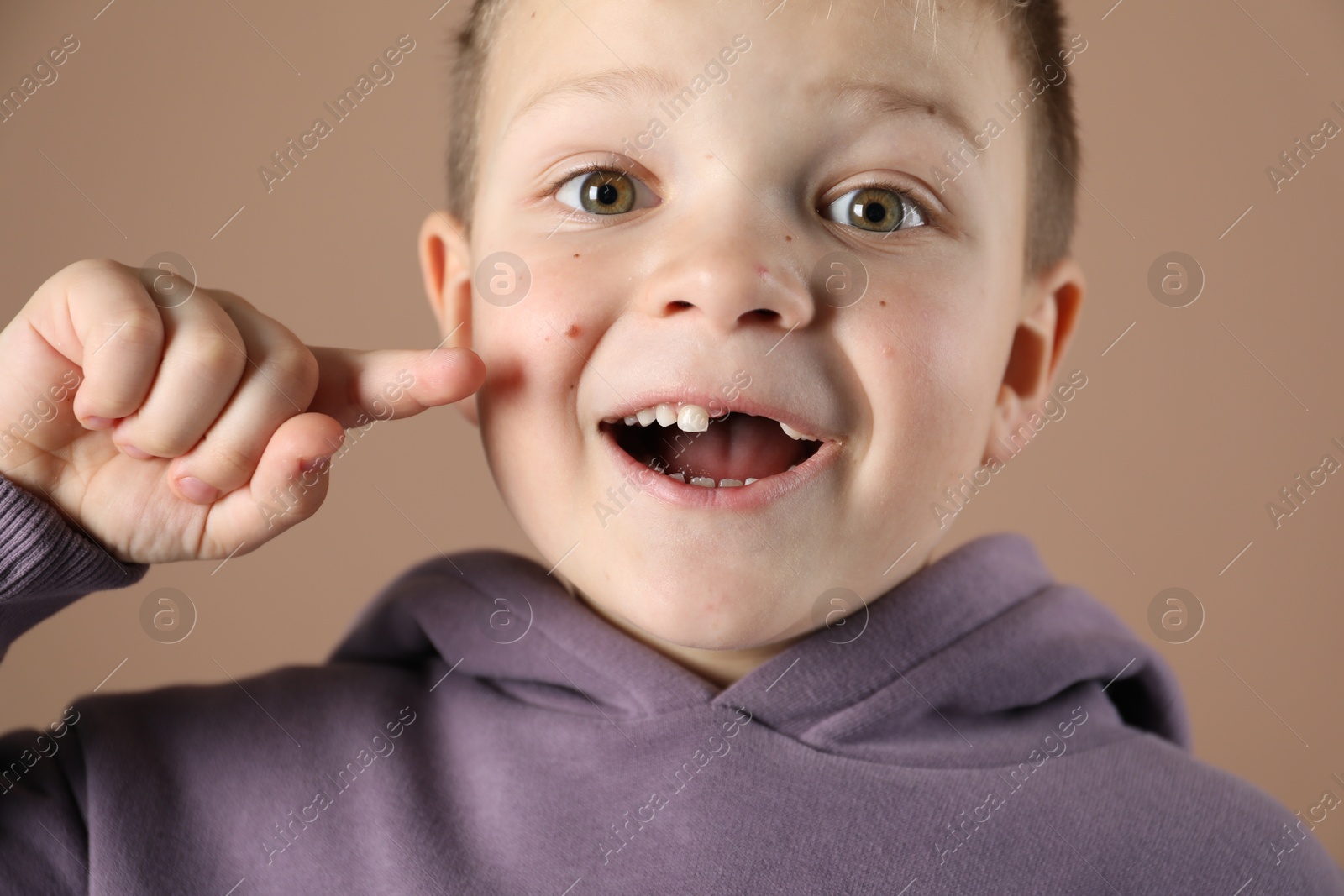 Photo of Cute little boy pointing at his missing tooth on dark beige background