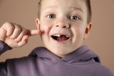 Cute little boy pointing at his missing tooth on dark beige background