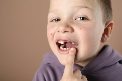 Photo of Cute little boy pointing at his missing tooth on dark beige background, closeup. Space for text