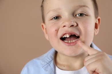 Photo of Cute little boy pointing at his missing tooth on dark beige background, closeup. Space for text