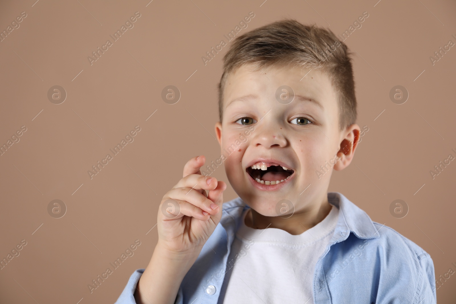 Photo of Cute little boy with missing tooth on dark beige background, space for text