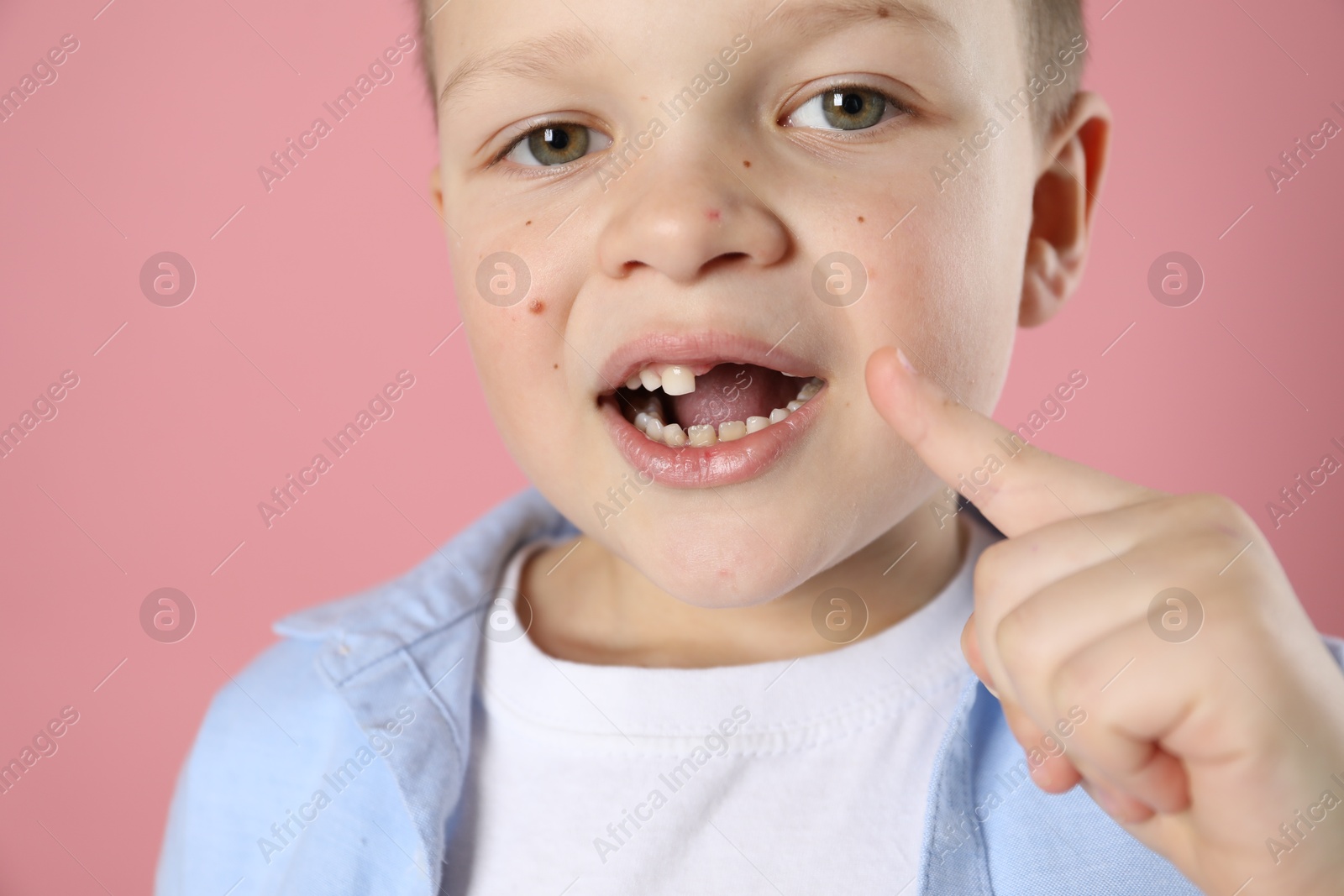 Photo of Cute little boy pointing at his missing tooth on pink background, closeup