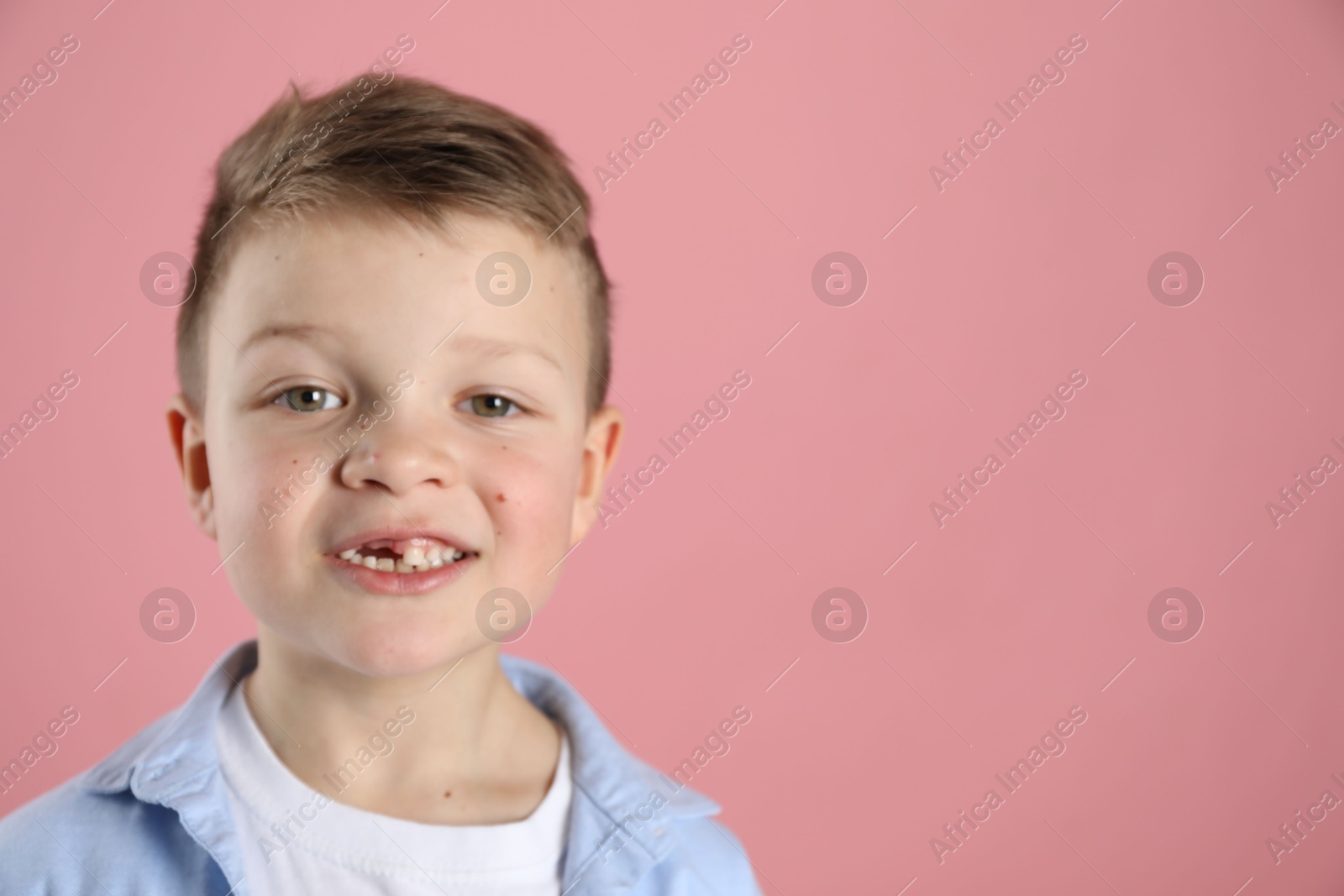 Photo of Cute little boy with missing tooth on pink background, space for text