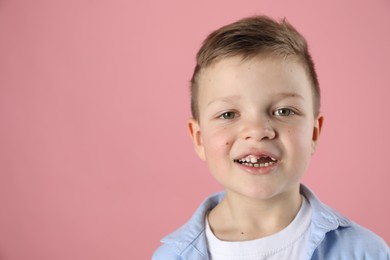 Cute little boy with missing tooth on pink background, space for text