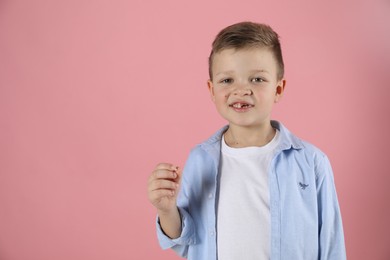 Photo of Cute little boy with missing tooth on pink background. Waiting for tooth fairy