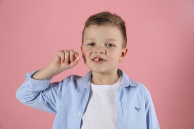 Photo of Cute little boy with missing tooth on pink background. Waiting for tooth fairy