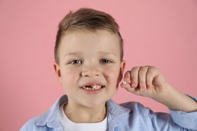 Photo of Cute little boy with missing tooth on pink background. Waiting for tooth fairy