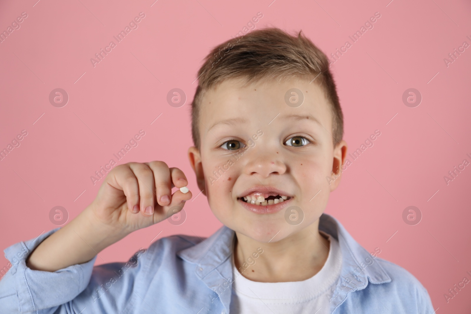 Photo of Cute little boy with missing tooth on pink background. Waiting for tooth fairy