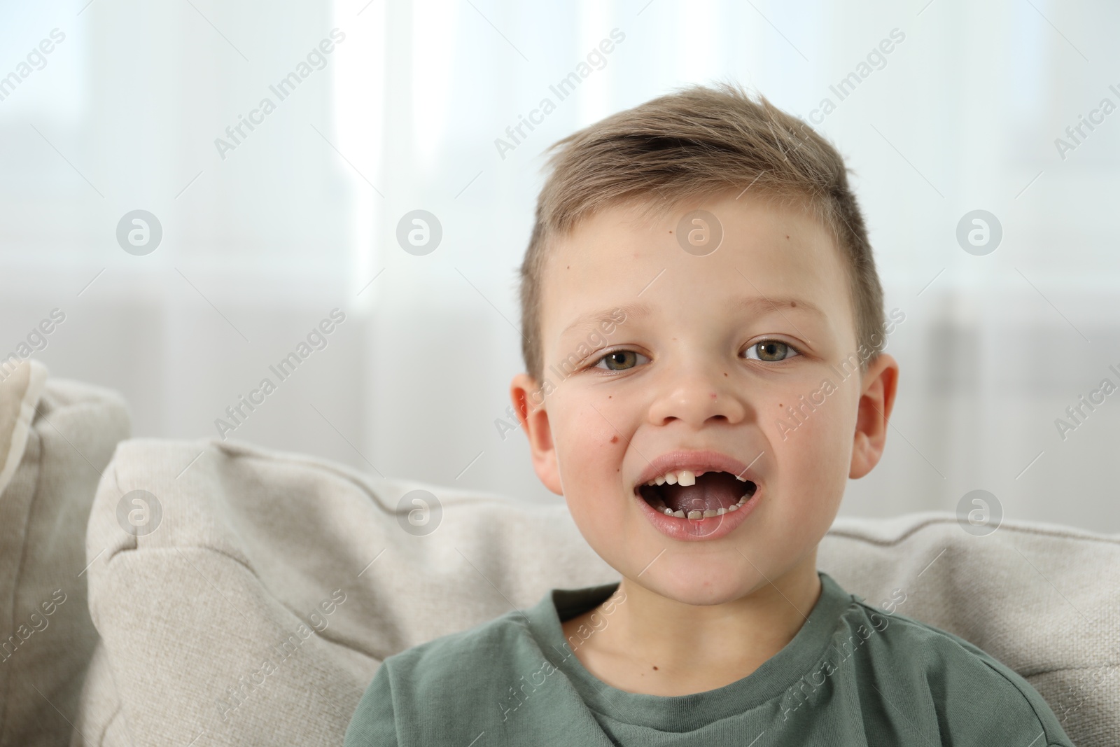 Photo of Cute little boy with missing tooth on sofa at home