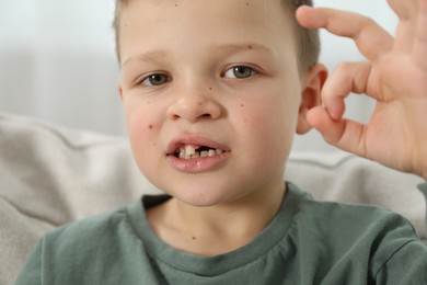 Photo of Cute little boy with missing tooth showing ok gesture at home