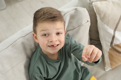 Photo of Cute little boy with missing tooth on sofa at home, above view. Waiting for tooth fairy