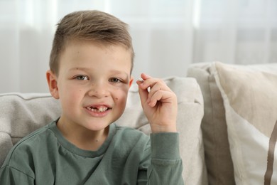 Photo of Cute little boy with missing tooth on sofa at home. Waiting for tooth fairy