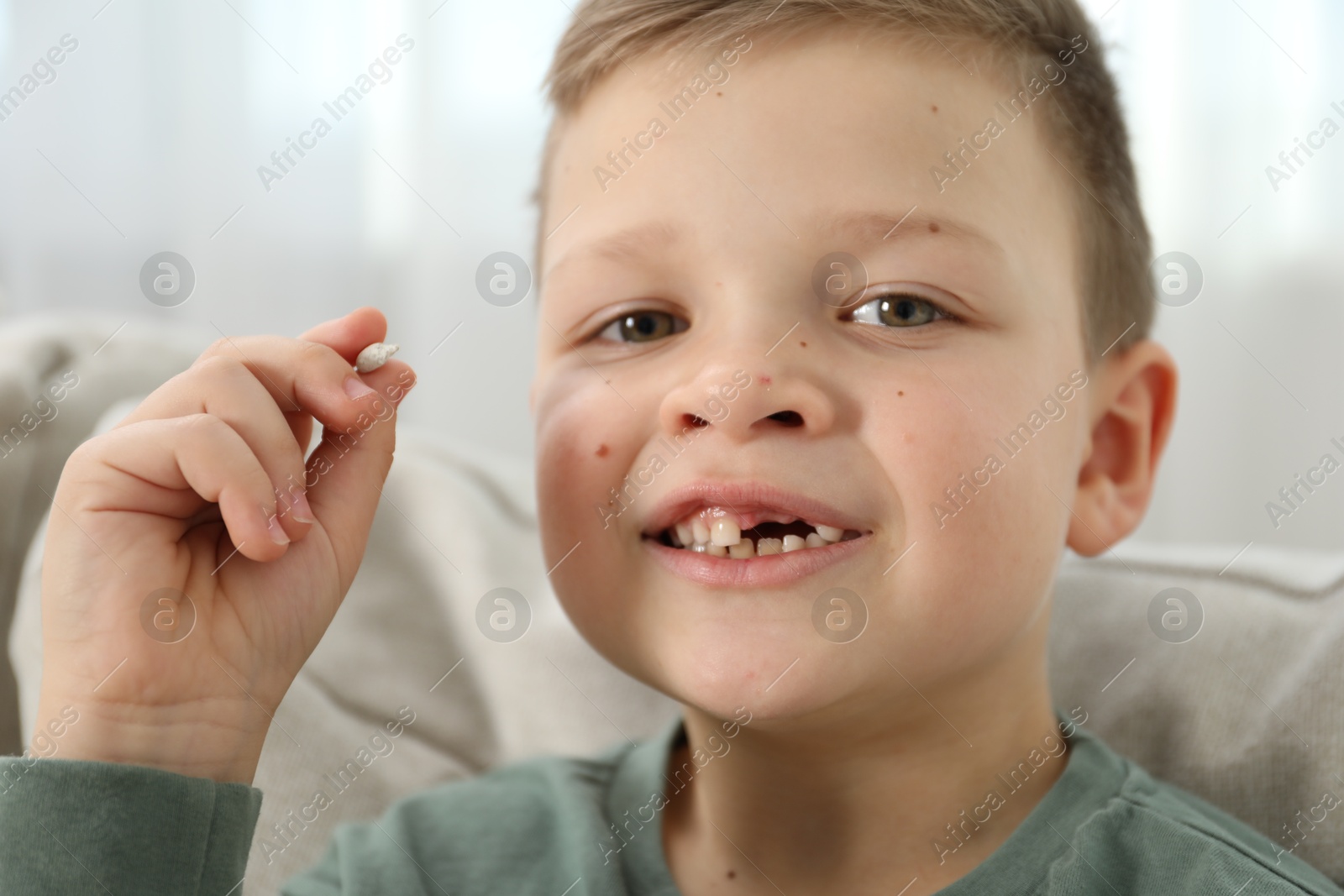 Photo of Cute little boy with missing tooth at home, closeup. Waiting for tooth fairy