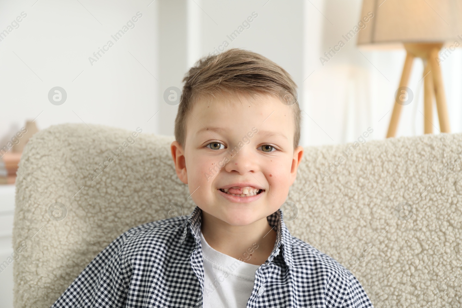 Photo of Cute little boy with missing tooth at home