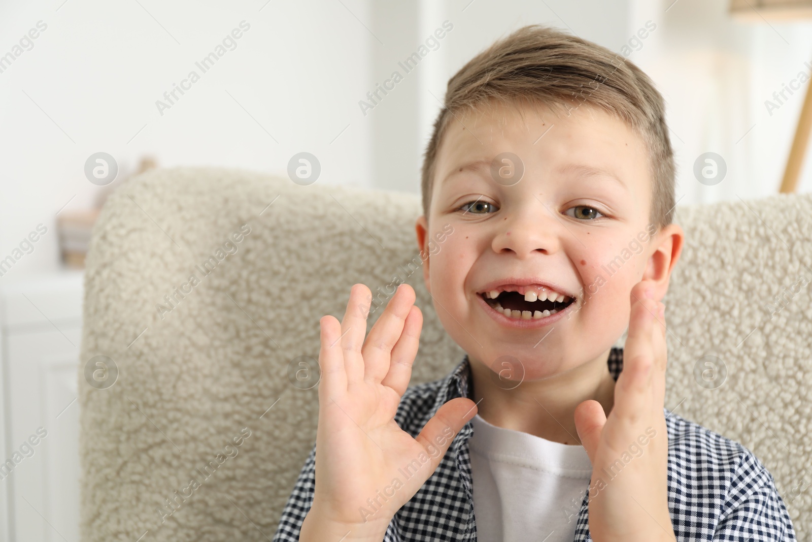 Photo of Cute little boy with missing tooth at home