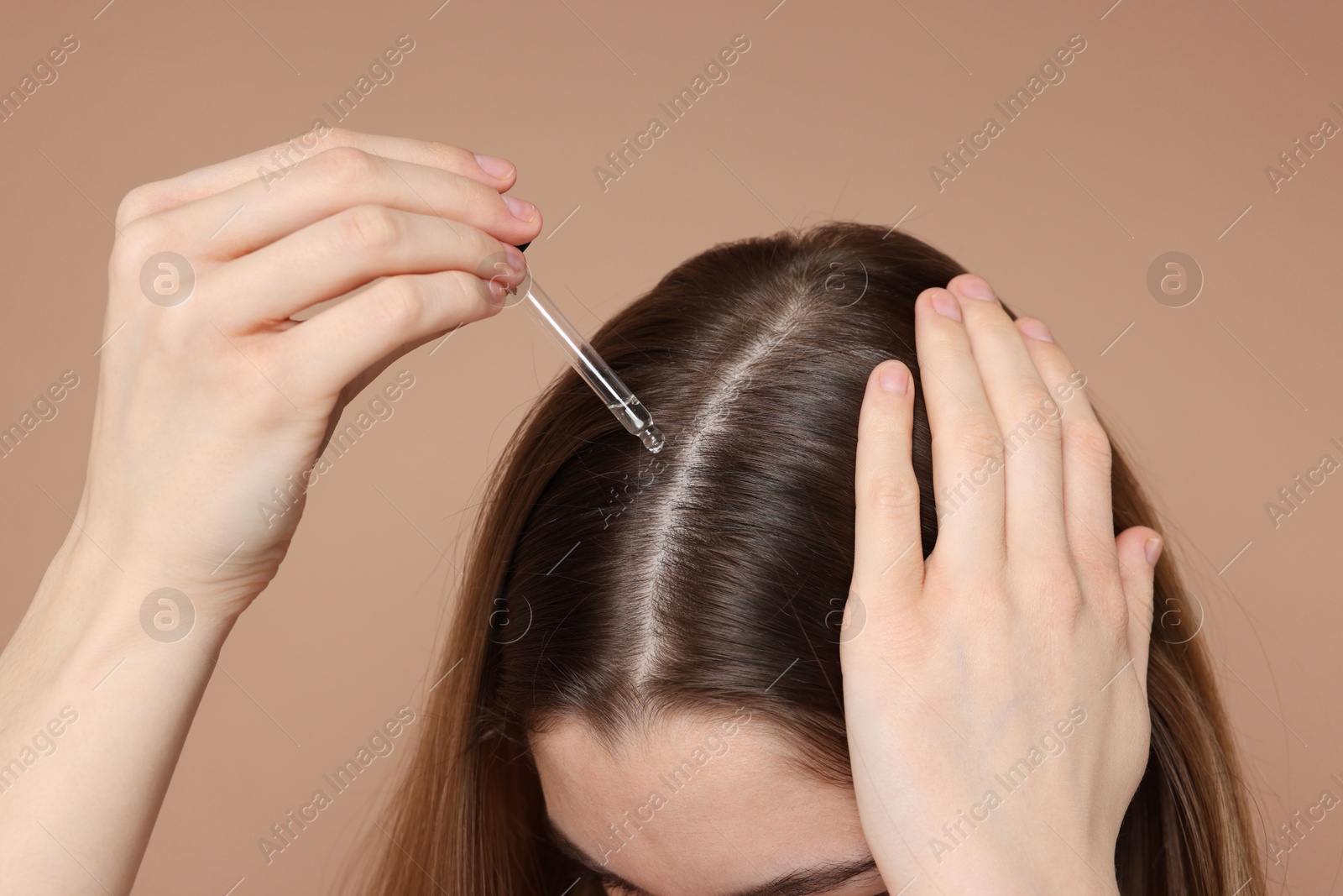 Photo of Hair loss problem. Girl applying serum onto hairline on dark beige background, closeup