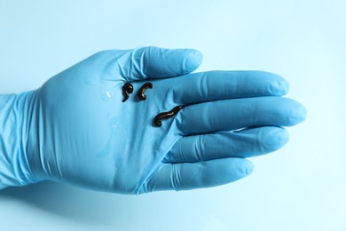 Photo of Doctor holding medicinal leeches on light blue background, closeup