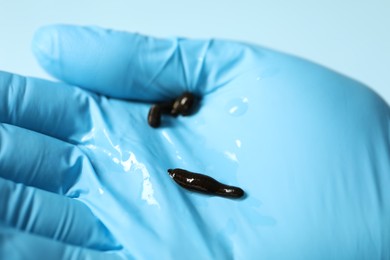 Photo of Doctor holding medicinal leeches on light blue background, closeup