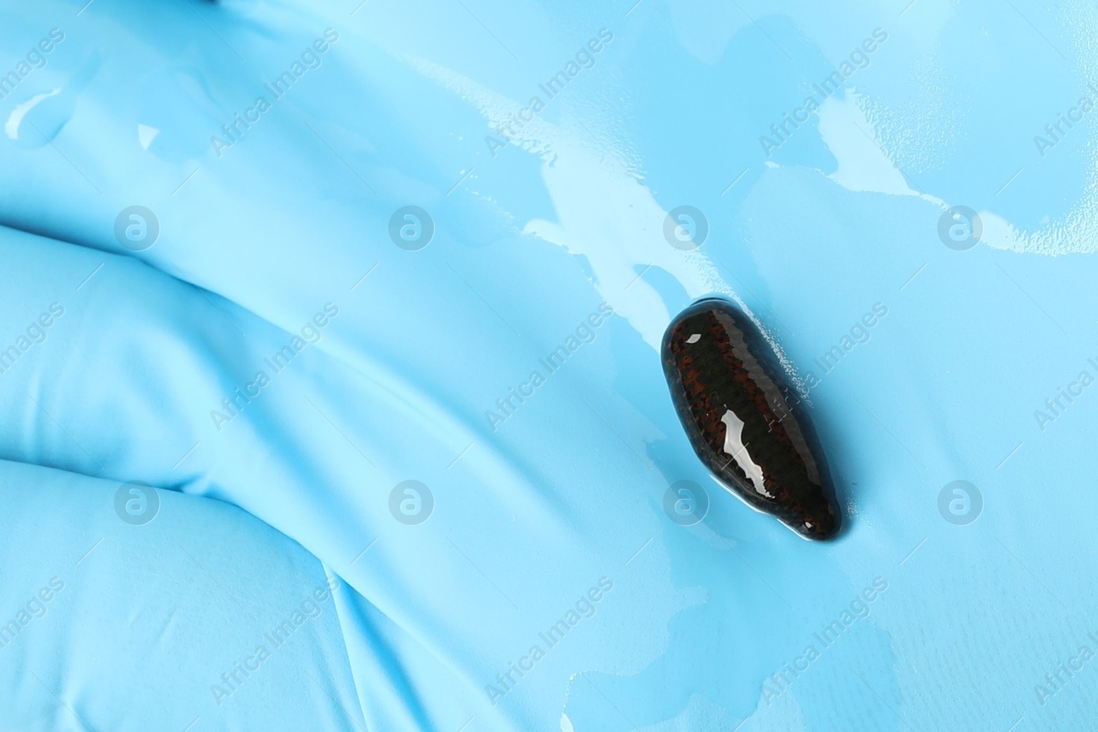 Photo of Doctor holding medicinal leech in hand, top view