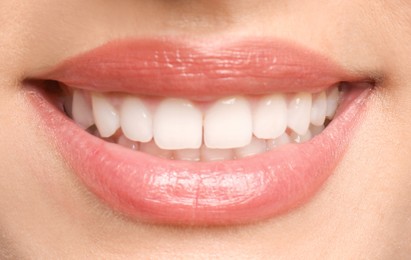 Image of Young woman with healthy teeth and beautiful smile, closeup