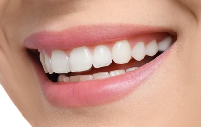 Image of Young woman with healthy teeth and beautiful smile, closeup