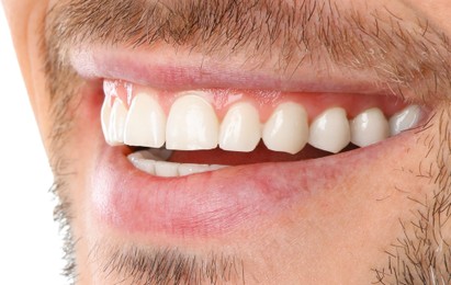 Image of Young man with healthy and white teeth, closeup